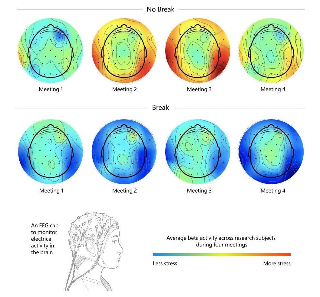 microsoft research brain scan